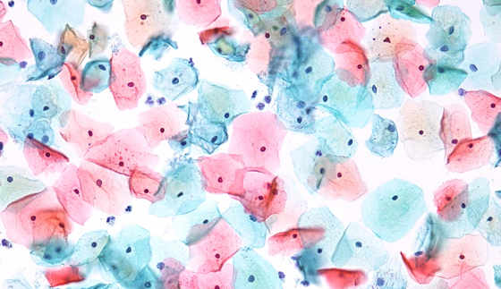 染色して顕微鏡でみた細胞の画像