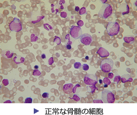 正常な骨髄の細胞