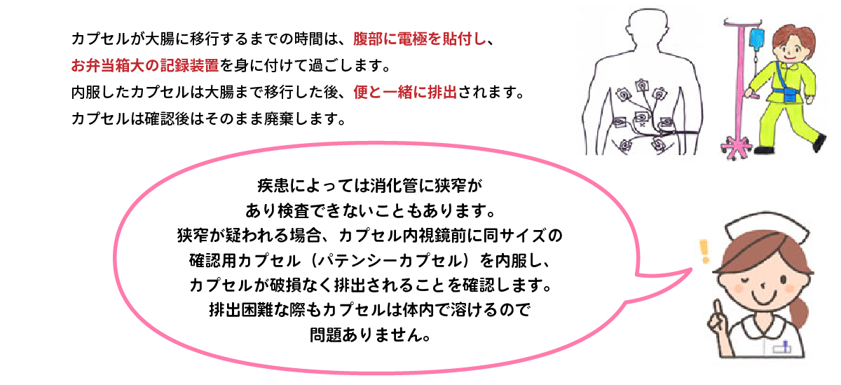 小腸カプセル内視鏡の流れ