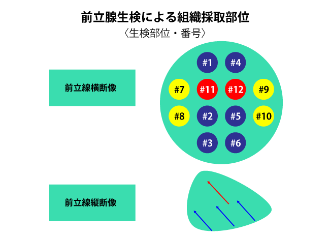 前立線生検部位・番号