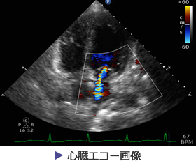 心臓エコー画像